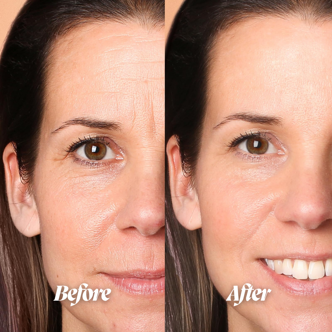 Glow LED Face Therapy Mask