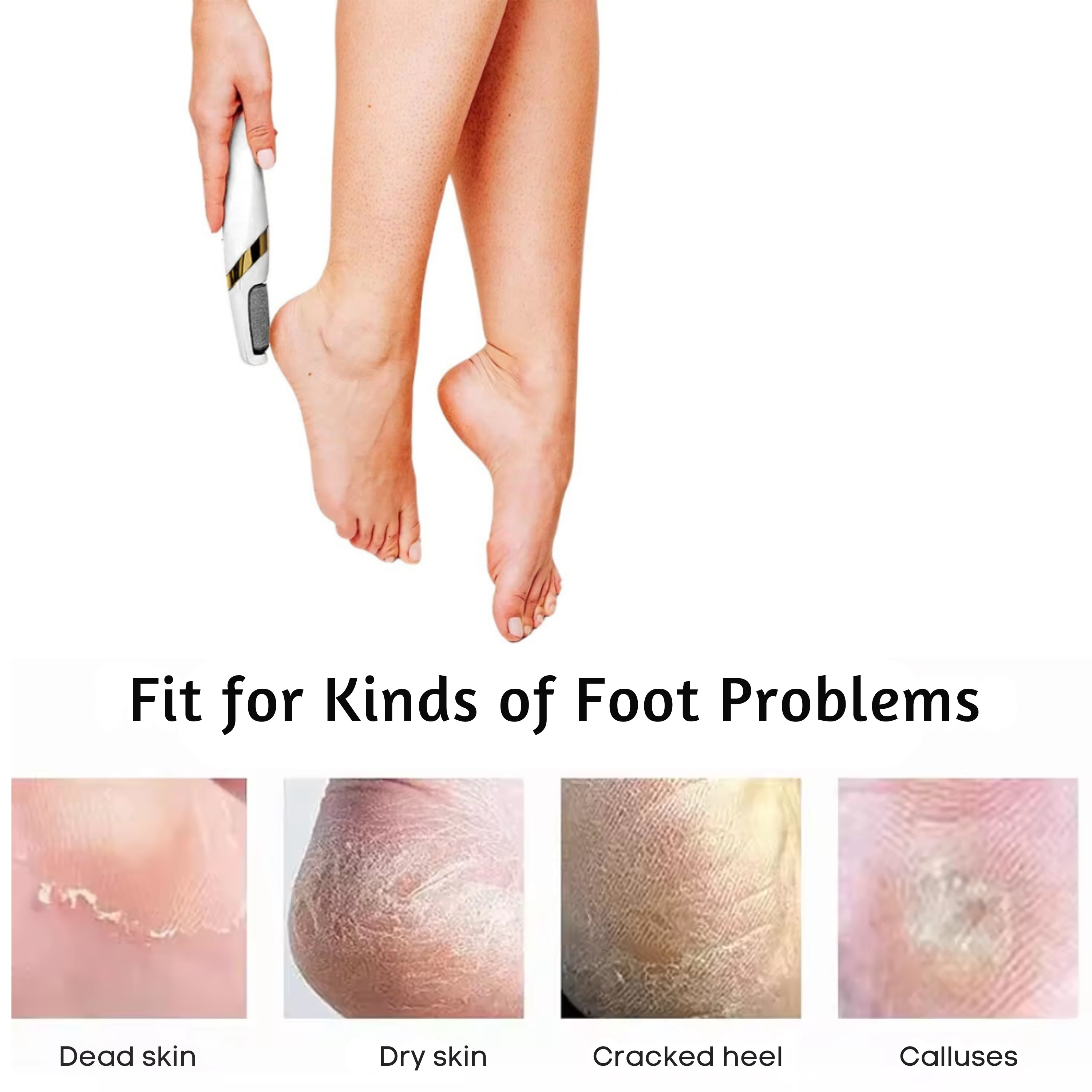 PediCare Rechargeable Callus Remover