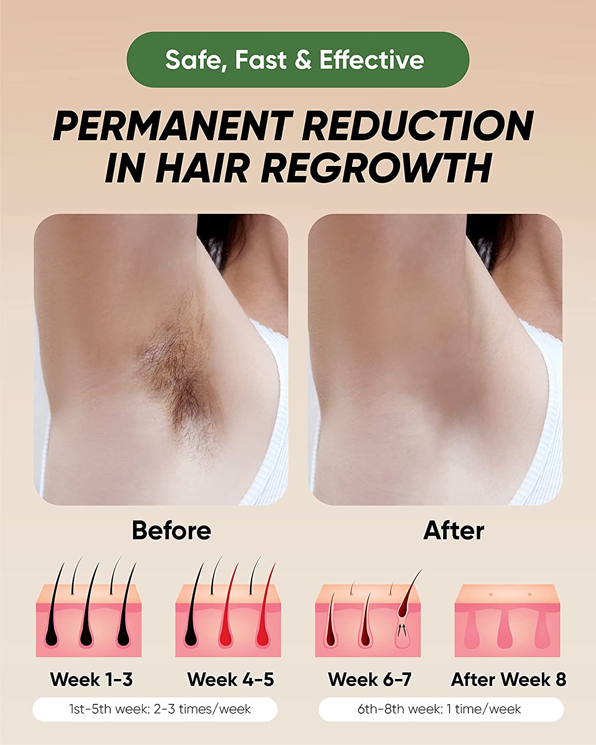 Wave IPL Laser Hair Removal Device
