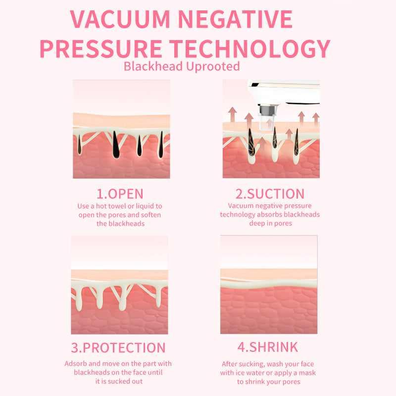 ClearPore Blackhead Remover