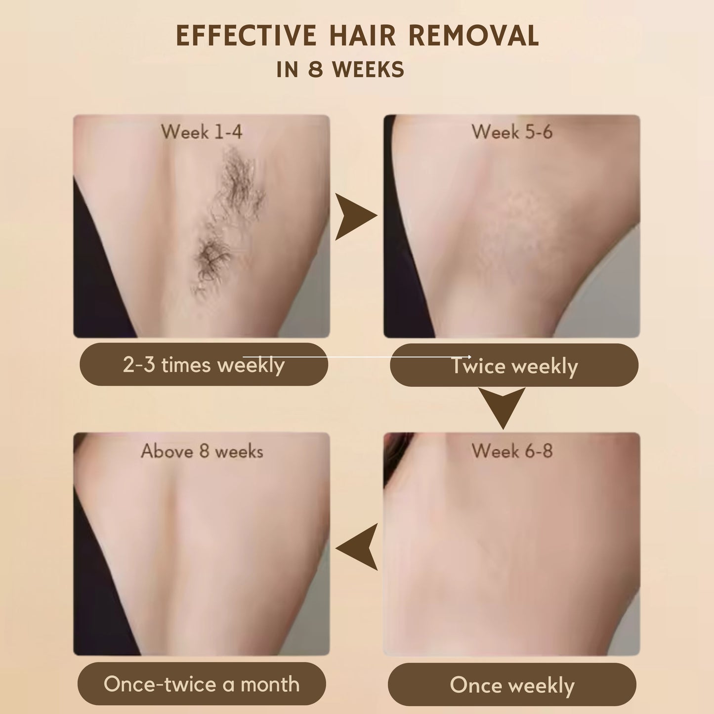 Flow IPL Laser Hair Removal Device