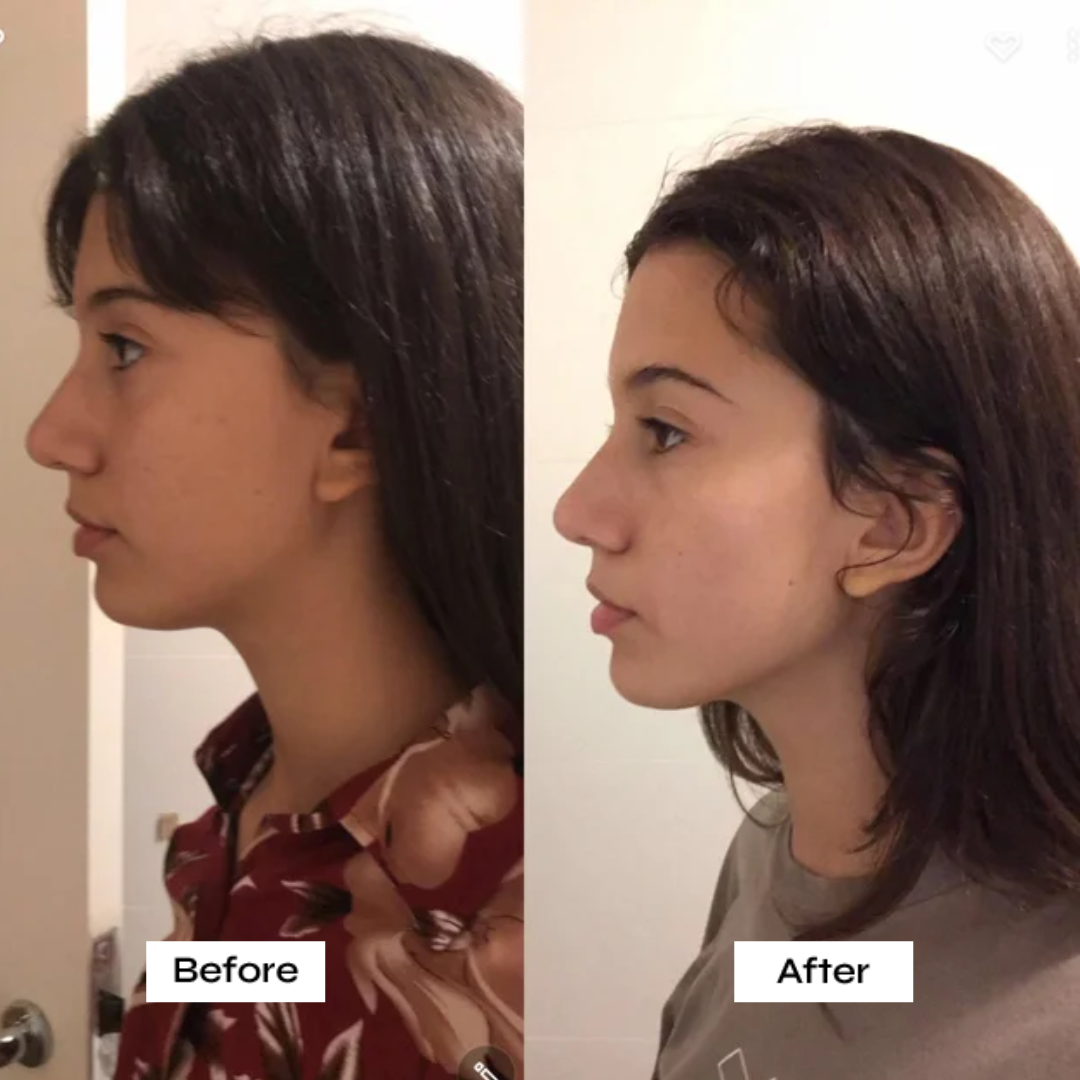 Sculpt Face & Neck Skin Lifting Device