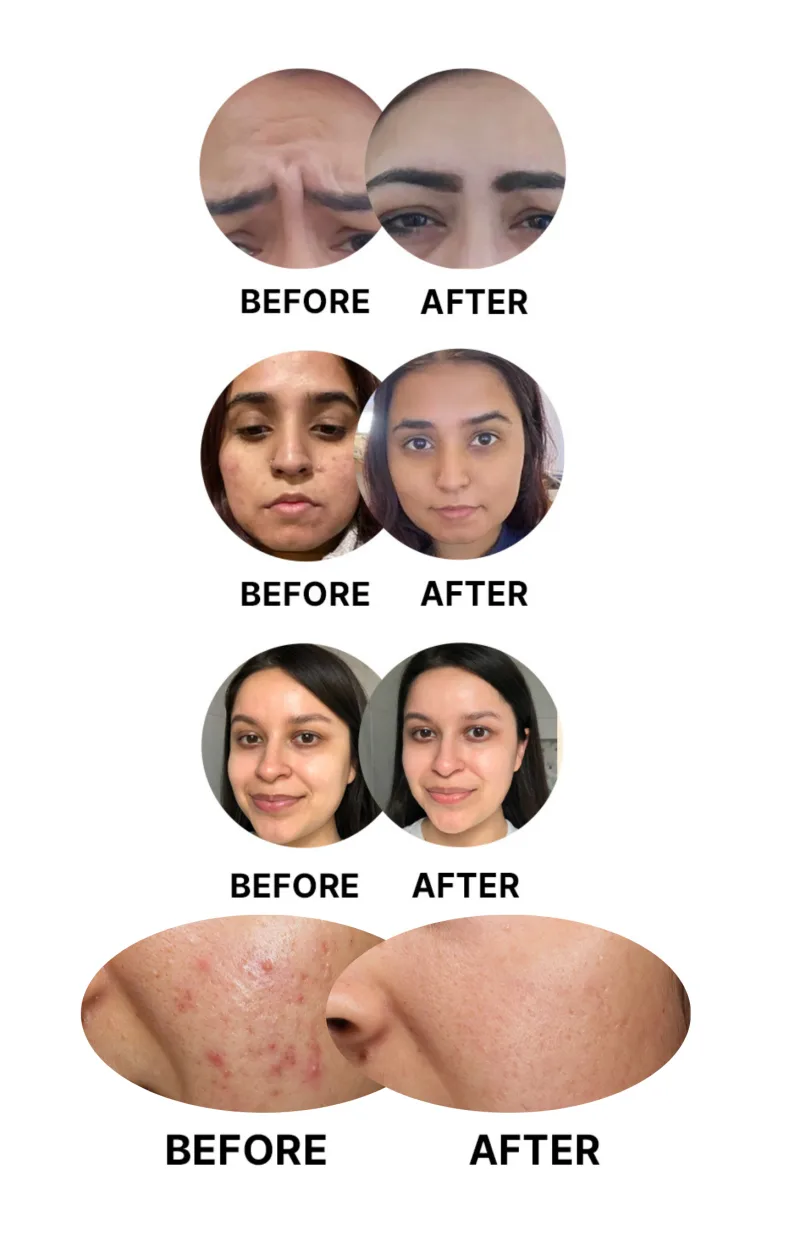 Glow LED Face Therapy Mask