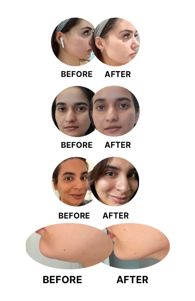 Sculpt Face & Neck Skin Lifting Device