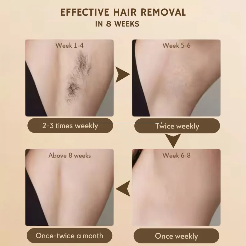 Flow IPL Laser Hair Removal Device