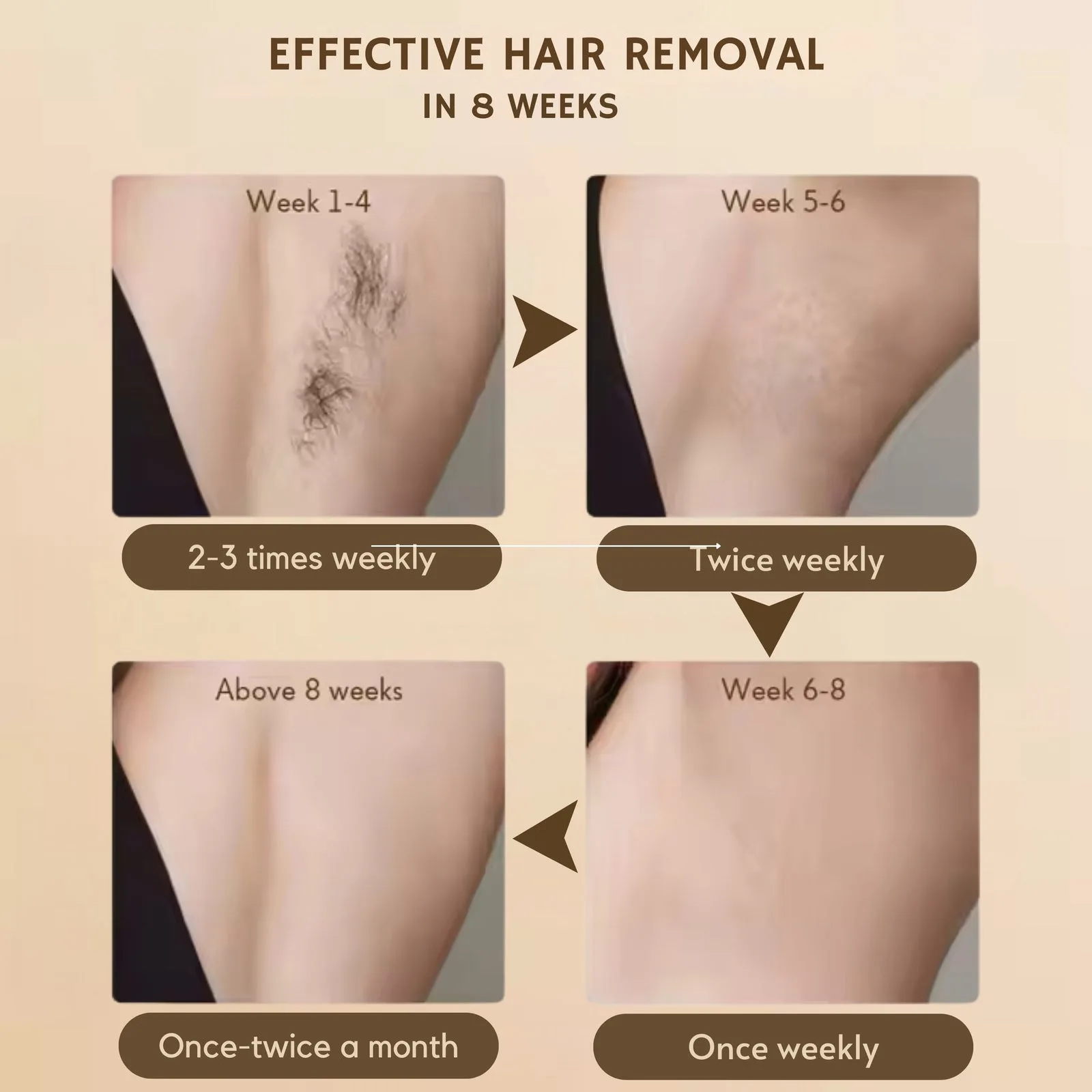 Flow IPL Laser Hair Removal Device