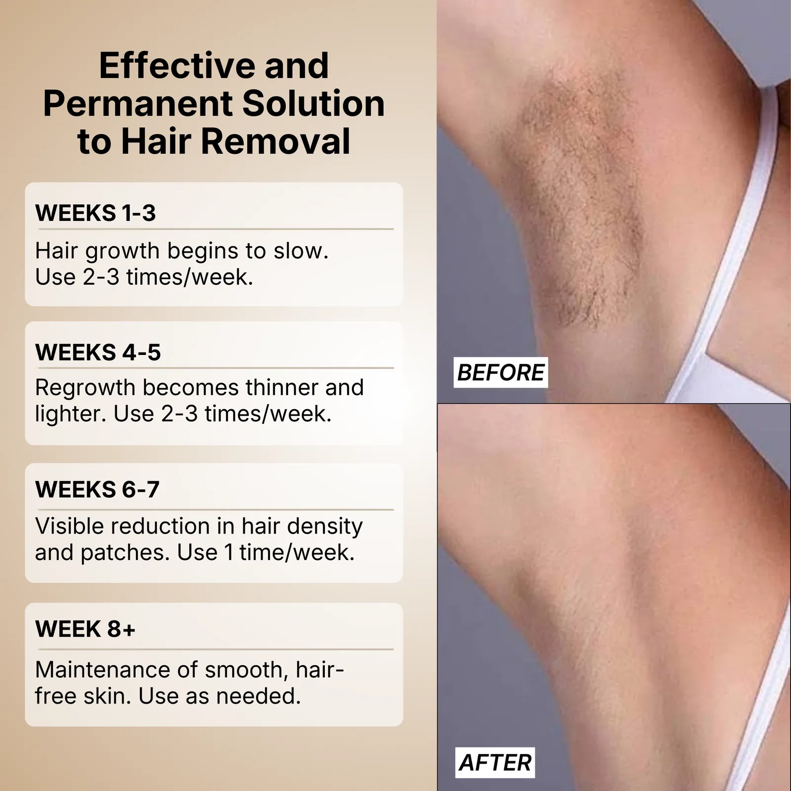 Wave IPL Laser Hair Removal Device